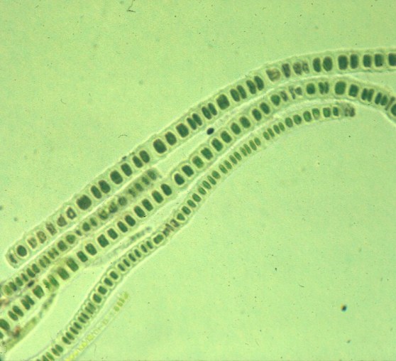 Week35_Photo2_bluegreenalgae